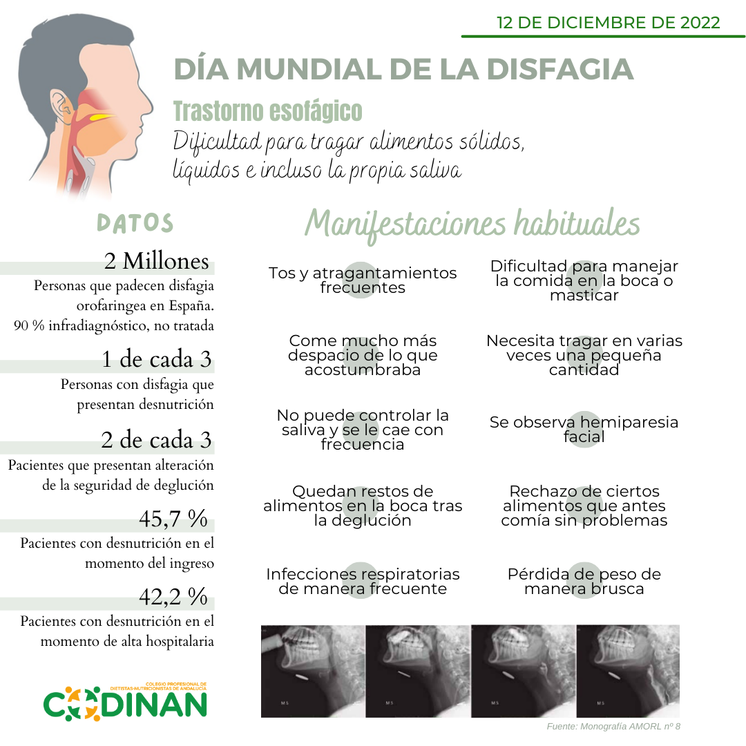 DÍA MUNDIAL DE LA DISFAGIA - CODINAN